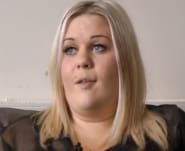 Della – Cleft lip and palate